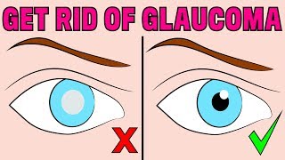 How to reverse chronic glaucoma naturally in 4 minutes a day