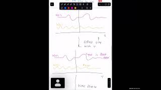 BME 350 Recitation 4: Convolution & Block Diagrams