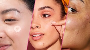 Top 7 pimple patches in 2025 (Best Sellers)