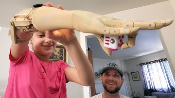 Unlimited Tomorrow - A young innovator revolutionizes the prosthetic industry