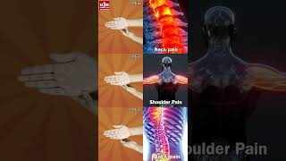 Simple 5-Minute Hand Acupressure for Neck, Shoulder, and Back Pain Relief!