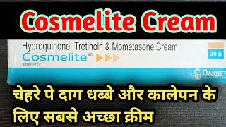 Cosmelite cream review in hindi | चेहरे पे दाग दब्बो के लिए सबसे अच्छा क्रीम