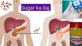 Sugar ka mukmal ilaj شوگر کی علامات اور ان کا جڑی بوٹیوں سے مکمل علاج ان شاءاللہ فائدہ ھو