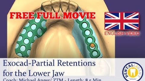 2019- FREE FULL TUTORIAL - EXOCAD-Partial Retentions for the Lower Jaw