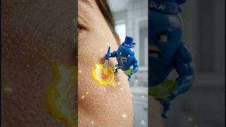 🍅 Lal Tamatar Pimple Fix! Dr. AI's Secret Remedy 🤫😂 #shorts #skincare