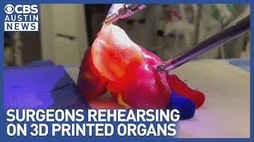 Lazarus 3D pioneers surgical rehearsal with 3D printed organs