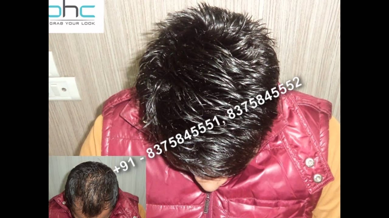 Hair bonding in Delhi Ncr Noida Gurgaon India YouTube