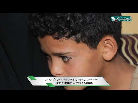 عائشة: قصة معاناة مع الظمور العضلي المزمن | سنابل الخير
