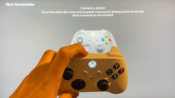 Xbox Series X/S: How to Unpair/Unsync Controllers Tutorial! (For Beginners)