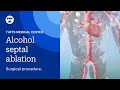 Alcohol septal ablation surgical procedure for hypertrophic cardiomyopathy hcm  tufts medicine