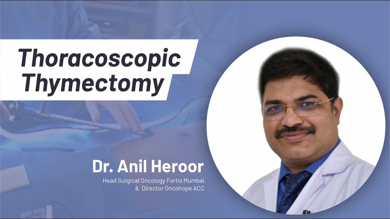 Thoracoscopic Thymectomy YouTube