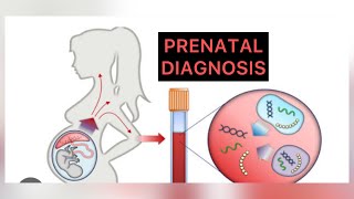 PRENATAL DIAGNOSIS part 1, #obs #obslectures #prenataldiagnosis
