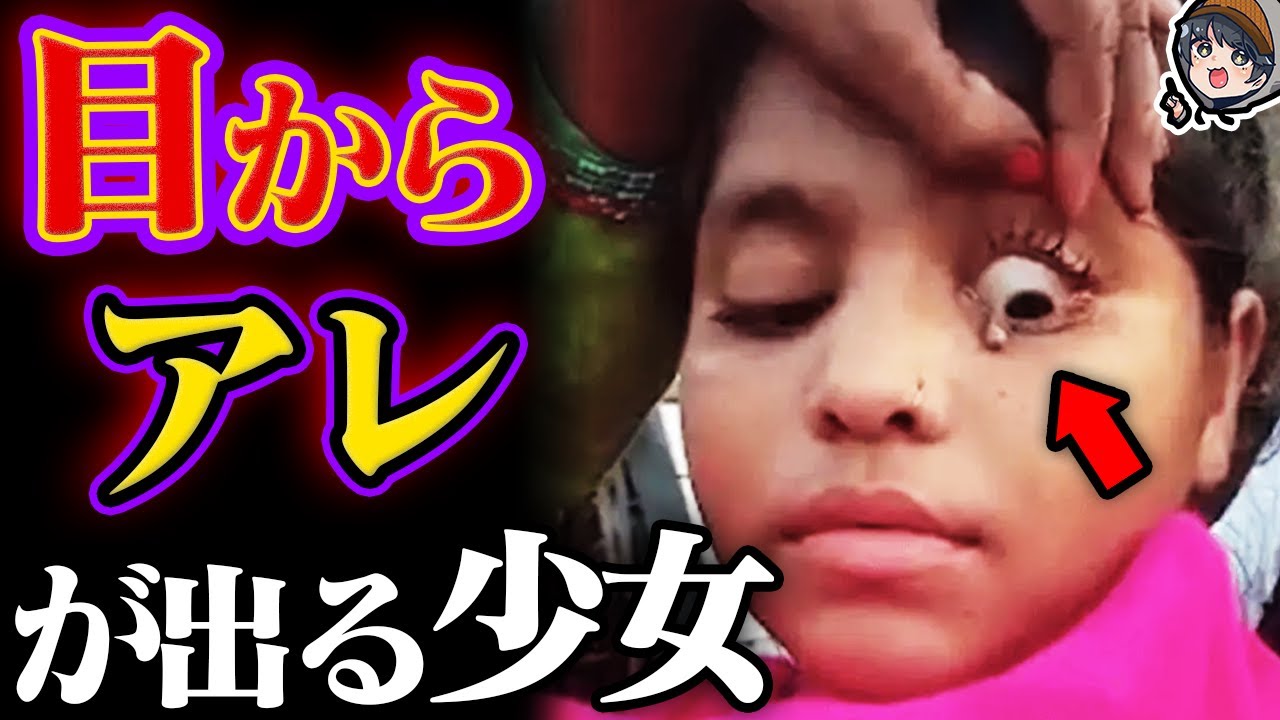 実在するとんでもない奇病12選 Youtube