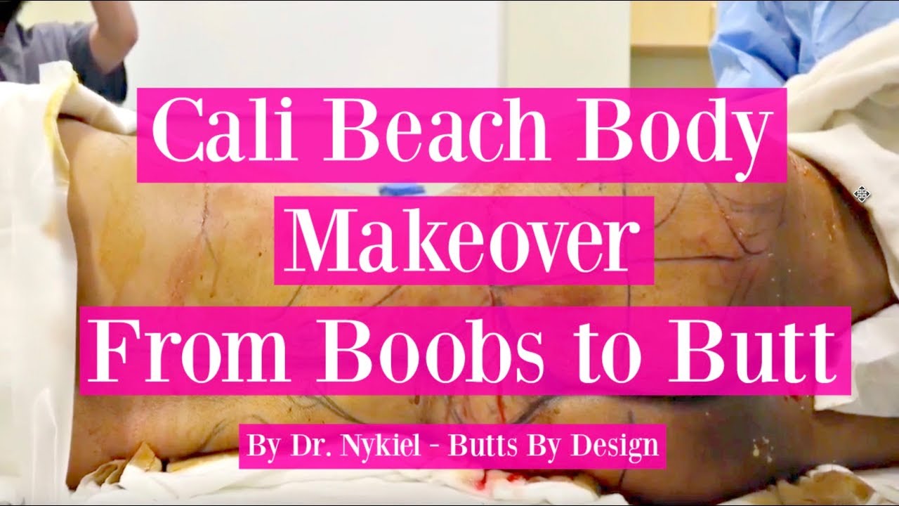 Cali Beach Body Makeover! Dr. Nykiel YouTube