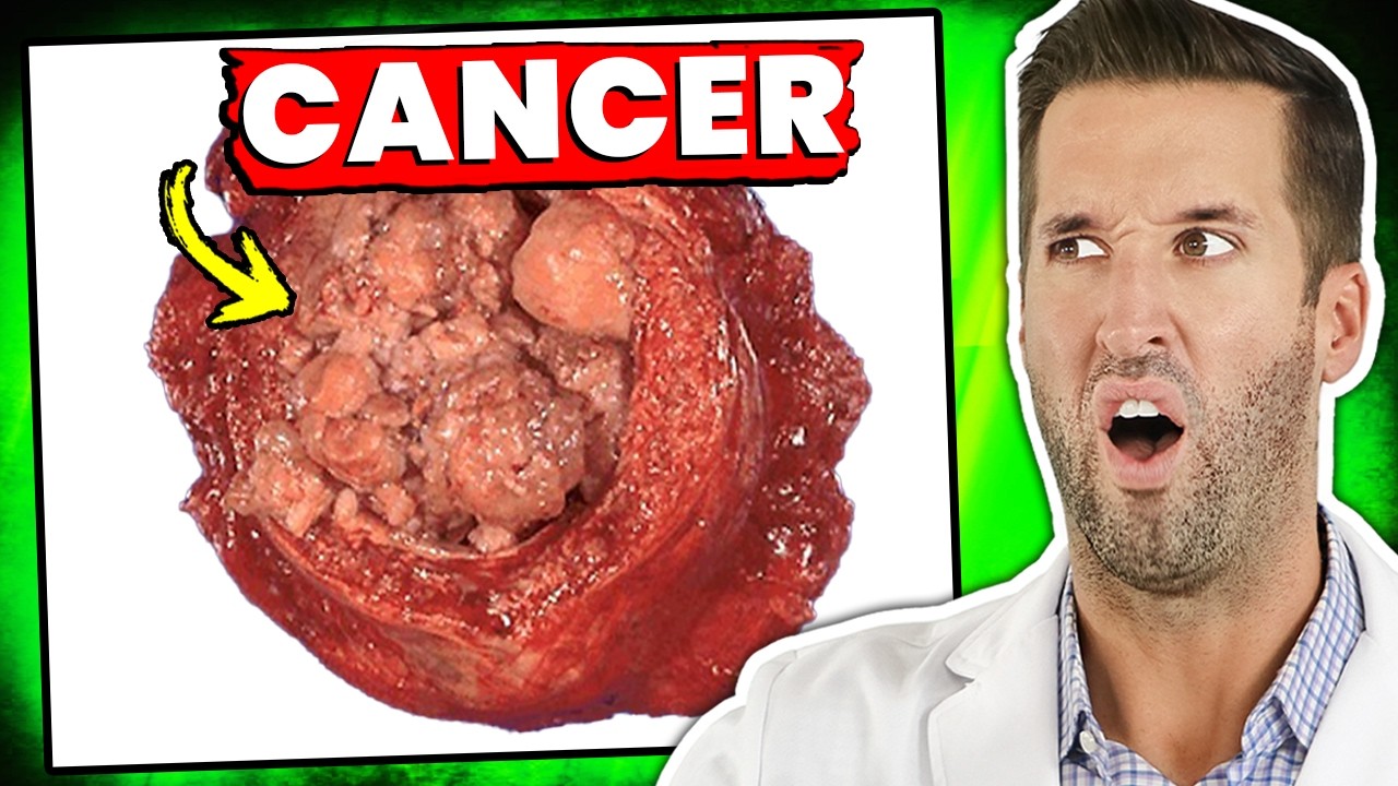 Is There a Cure for Cancer? | Reacting to Your Medical Questions