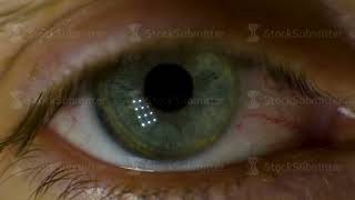 Extreme Macro of a brown eye. Video. Closeup of man's eye. spot in the eye. macro. High dynamic