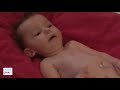 Learn to Spot the Warning Signs of SMA – Floppy Baby (Video 5)