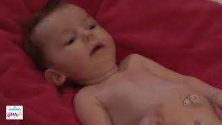 Learn to Spot the Warning Signs of SMA – Floppy Baby (Video 5) screenshot 2