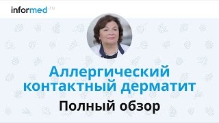 Аллергический контактный дерматит: обзор, симптомы, диагностика, лечение, профилактика.