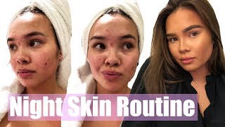 Huden min var grusom før | Night Skin Routine - YouTube