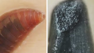 Amazing Microscopic World! Macro Footage And 2000x Zooming