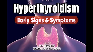 Hyperthyroidism (Overactive Thyroid) - Dr. Gary Sy