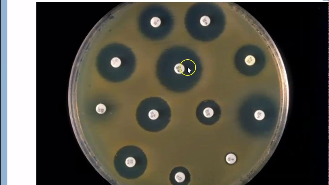 Antibiotics and Antituberculars 2020