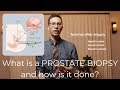 Prostate biopsy procedure explained by urologist