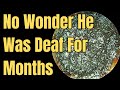 No Wonder He Was Deaf For Months