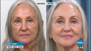 Nakery Beauty Advanced Instant Wrinkle Eraser AutoShip