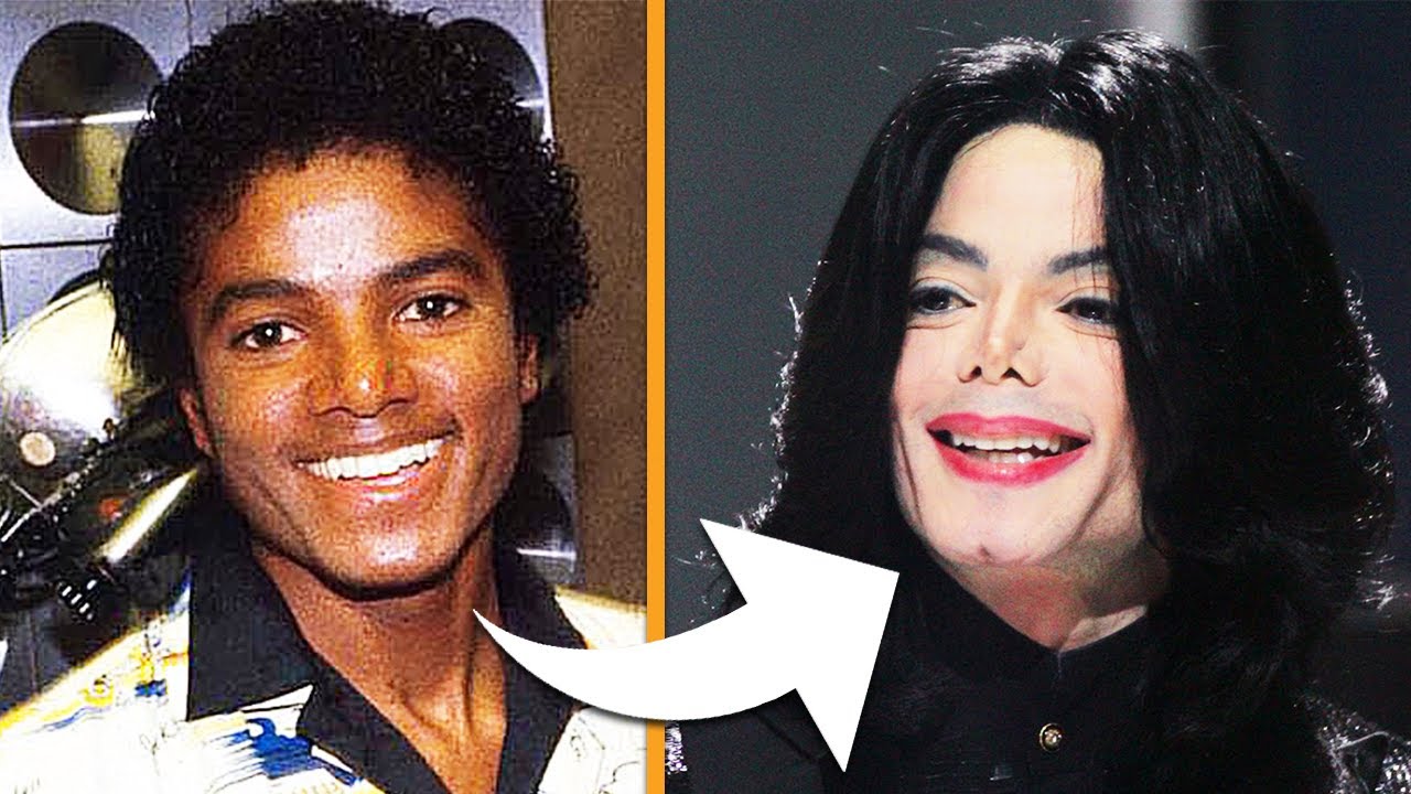 The Evolution of Michael Jackson’s Face: Exploring Controversy and Change