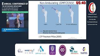 Day1 16 Does early soft tissue release prevent progress spastic hip dysplasia-Dr Mostafa Elsherbiny