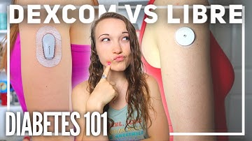 DEXCOM VS LIBRE - which should YOU choose?