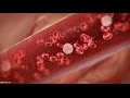 Причины, симптомы и лечение лейкемии у взрослых и детей