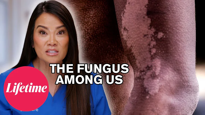 Dr. Lee Treats Carter’s Stubborn Rash | Dr. Pimple Popper: Breaking Out (S1) | Lifetime