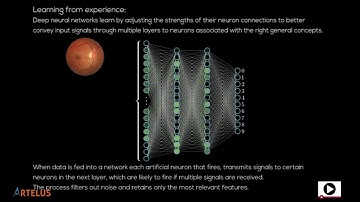Pradeep Walia | Solving Diabetic Retinopathy with Artificial Intelligence