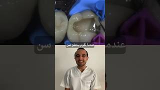 استرجاع شكل الأسنان ؟ طبيب_أسنان المغرب dentiste maroc