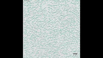 Bacterial Swarming (High Density)