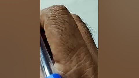 Banach Spaces- Lecture 06