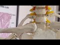 Osteology of First Rib ( Real bone) by KUSHALA, I MBBS student,SCMCHRI
