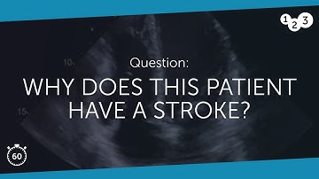 60 Seconds of Echo Teaching Question: Why did this patient have a stroke?