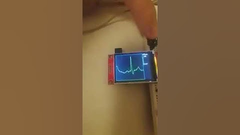 AD8232 ECG module on ESP32 - working prototype