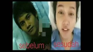 Melly Bradley Bongkar Wajah Asli Lucinta Luna Sebelum Operasi Plastik