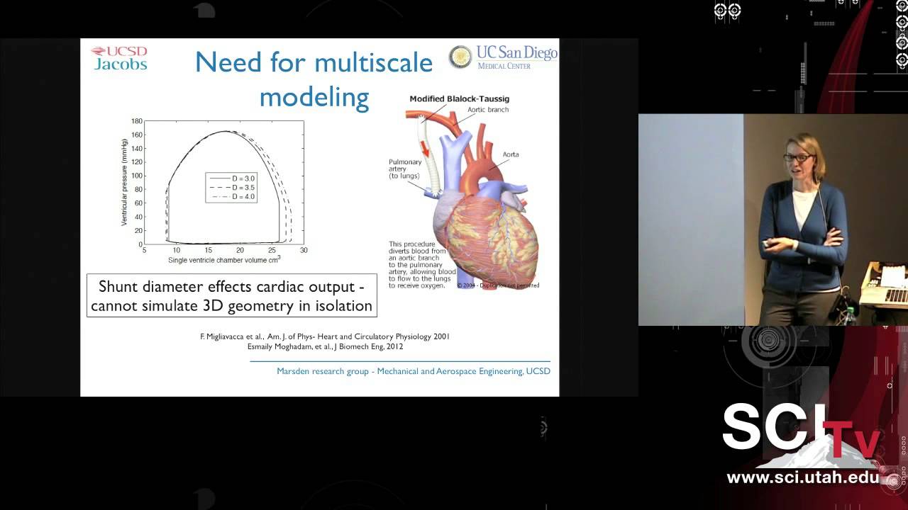 Simulation-based treatment planning in pediatric cardiology