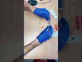 طريقة تحضير حقنة الفيتامين دون ان اذي يدي
