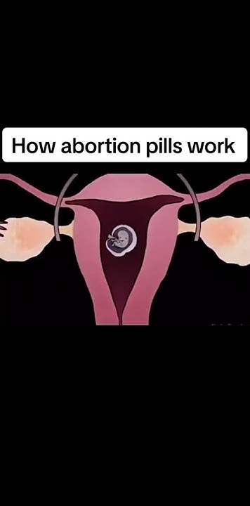 How Abortion Pill Work Animation In Hindi How abortion pills work #shorts #reels - YouTube