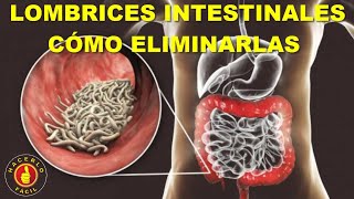 LOMBRICES INTESTINALES - CÓMO ELIMINARLAS FÁCILMENTE