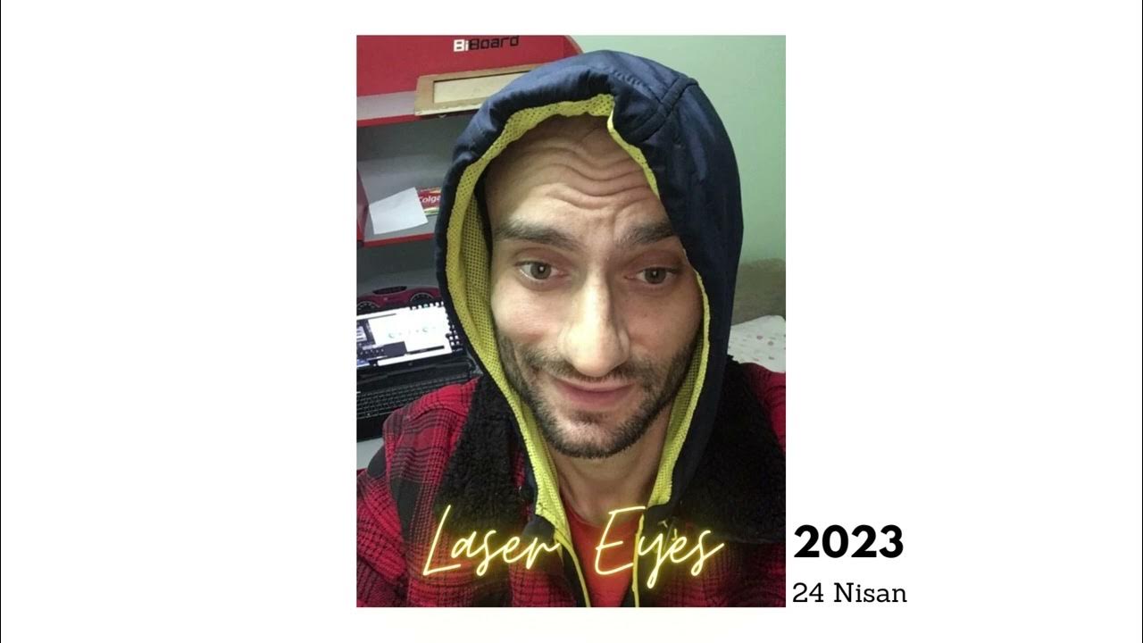 Laser Eyes RÖNTGEN (ProdLaser Eyes) YouTube