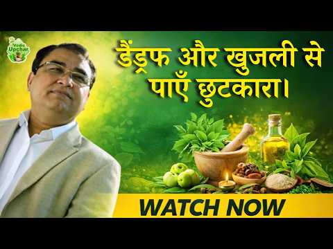 Get Rid of Dandruff and Itching Naturally | Vedic Upchar | #dandruff #itching #hair #haircare #tips