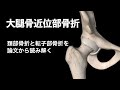 【医学】頚部骨折と転子部骨折を論文から読み解く・大腿骨近位部骨折